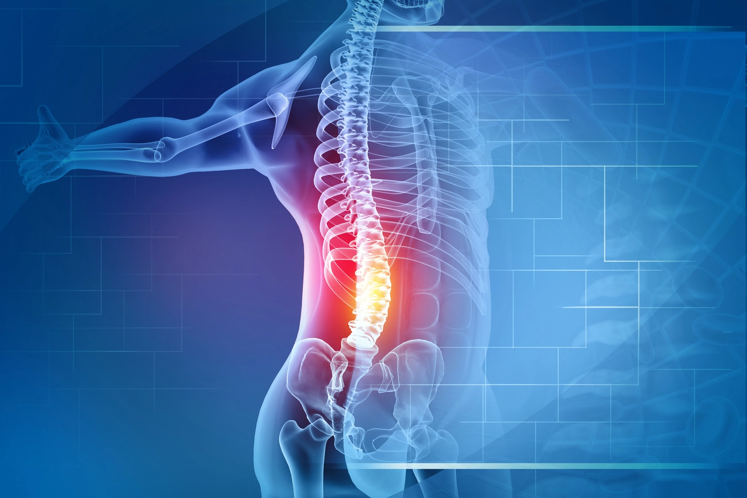 Dr. Tareq Soumma Cum Laude – Orthopäde für Hüfte – Schmerzen in der Wirbelsäule, Schmerzen im Rücken, rot hervorgehoben, Röntgenaufnahme. 3D-Illustration